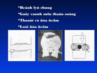 Beânh lyù chung
Gaõy vaønh suïn thaân soáng
Thoaùt vò ñóa ñeäm
Loài ñóa ñeäm

 