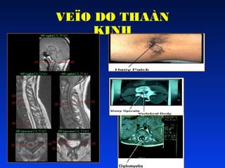 VEÏO DO THAÀN
KINH

 