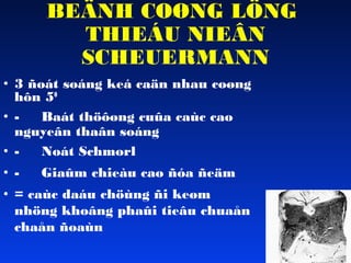 BEÄNH COØNG LÖNG
THIEÁU NIEÂN
SCHEUERMANN
• 3 ñoát soáng keá caän nhau coøng
hôn 50
• Baát thöôøng cuûa caùc cao
nguyeân thaân soáng
• Noát Schmorl
• -

Giaûm chieàu cao ñóa ñeäm

• = caùc daáu chöùng ñi keøm
nhöng khoâng phaûi tieâu chuaån
chaån ñoaùn

 