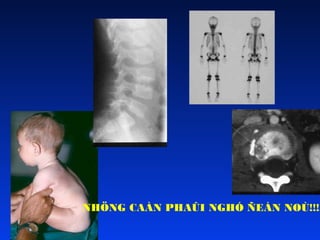 NHÖNG CAÀN PHAÛI NGHÓ ÑEÁN NOÙ!!!!

 