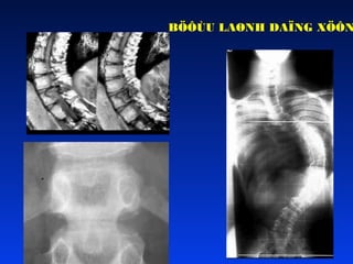 BÖÔÙU LAØNH DAÏNG XÖÔN

 