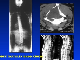 ÖÔÙU NGUYEÂN BAØO XÖÔNG

 