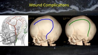 Wound Complications
 
