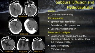 Subdural Effusion and
Hydrocephalus
Causes
• CSF flow abnormality
Consequences
• Spontaneous resolution
• Retardation of improvement
• Secondary deterioration
Measures to mitigate
• Superior and medial margin of the
craniotomy should not be closer than
2.5 cm from midline
• Early cranioplasty
• CSF diversion
06.09.2018
09.09.2018
16.09.2018 25.09.2018 24.09.2019
 