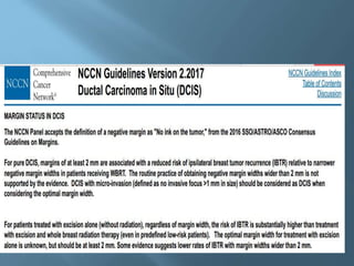 Ductal carcinoma in situ | PPTX