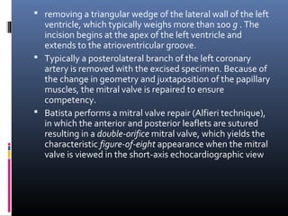  removing a triangular wedge of the lateral wall of the left
  ventricle, which typically weighs more than 100 g . The
  incision begins at the apex of the left ventricle and
  extends to the atrioventricular groove.
 Typically a posterolateral branch of the left coronary
  artery is removed with the excised specimen. Because of
  the change in geometry and juxtaposition of the papillary
  muscles, the mitral valve is repaired to ensure
  competency.
 Batista performs a mitral valve repair (Alfieri technique),
  in which the anterior and posterior leaflets are sutured
  resulting in a double-orifice mitral valve, which yields the
  characteristic figure-of-eight appearance when the mitral
  valve is viewed in the short-axis echocardiographic view
 