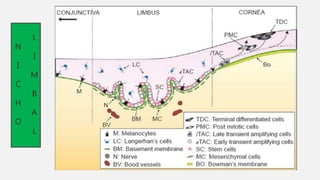 DEFICIENCIA DE CELULAS MADRE LIMBARES | PPT