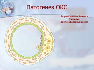 Dcmp