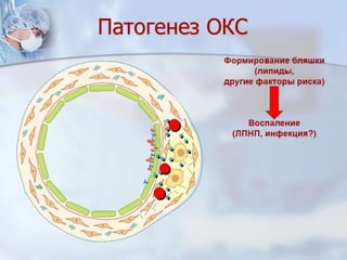 Dcmp