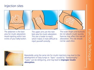 DC_PE_Getting-Started-With-Insulin-Injections_CE_EN.pdf