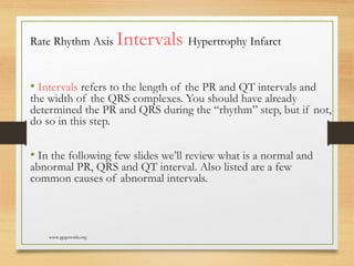 Electro Cardio Gram - Basics of ECG | PPT