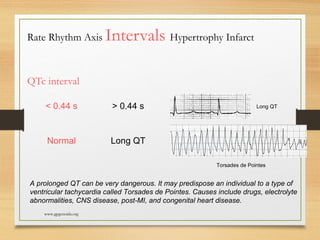 Electro Cardio Gram - Basics of ECG | PPT