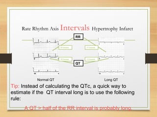 Electro Cardio Gram - Basics of ECG | PPT