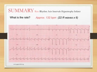 Electro Cardio Gram - Basics of ECG | PPT