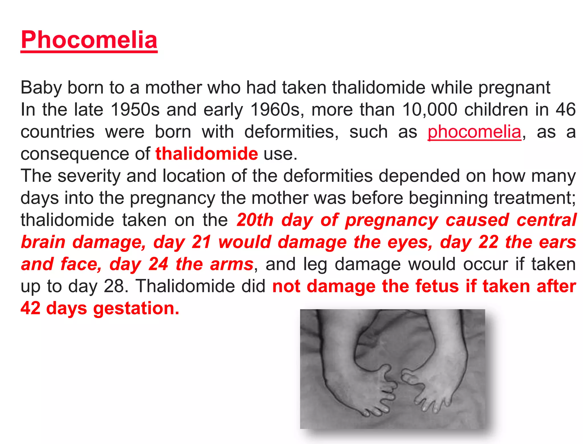 Phocomelia
Baby born to a mother who had taken thalidomide while pregnant
In the late 1950s and early 1960s, more than 10,000 children in 46
countries were born with deformities, such as phocomelia, as a
consequence of thalidomide use.
The severity and location of the deformities depended on how many
days into the pregnancy the mother was before beginning treatment;
thalidomide taken on the 20th day of pregnancy caused central
brain damage, day 21 would damage the eyes, day 22 the ears
and face, day 24 the arms, and leg damage would occur if taken
up to day 28. Thalidomide did not damage the fetus if taken after
42 days gestation.
 