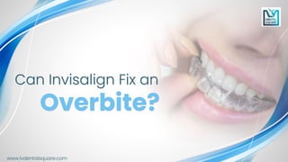 how Invisalign can fix an overbite | PDF