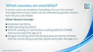 how Invisalign can fix an overbite | PDF