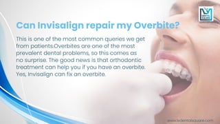 how Invisalign can fix an overbite | PDF