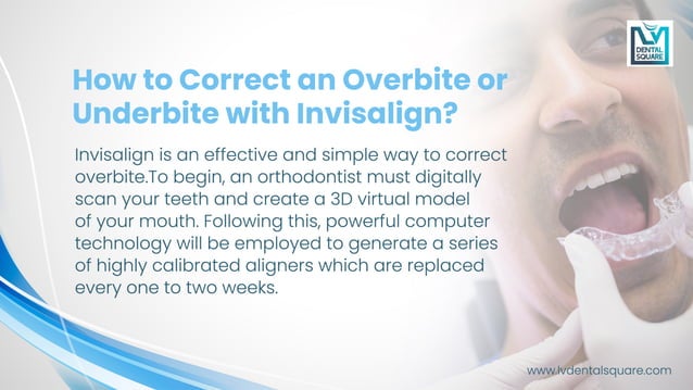 how Invisalign can fix an overbite | PDF