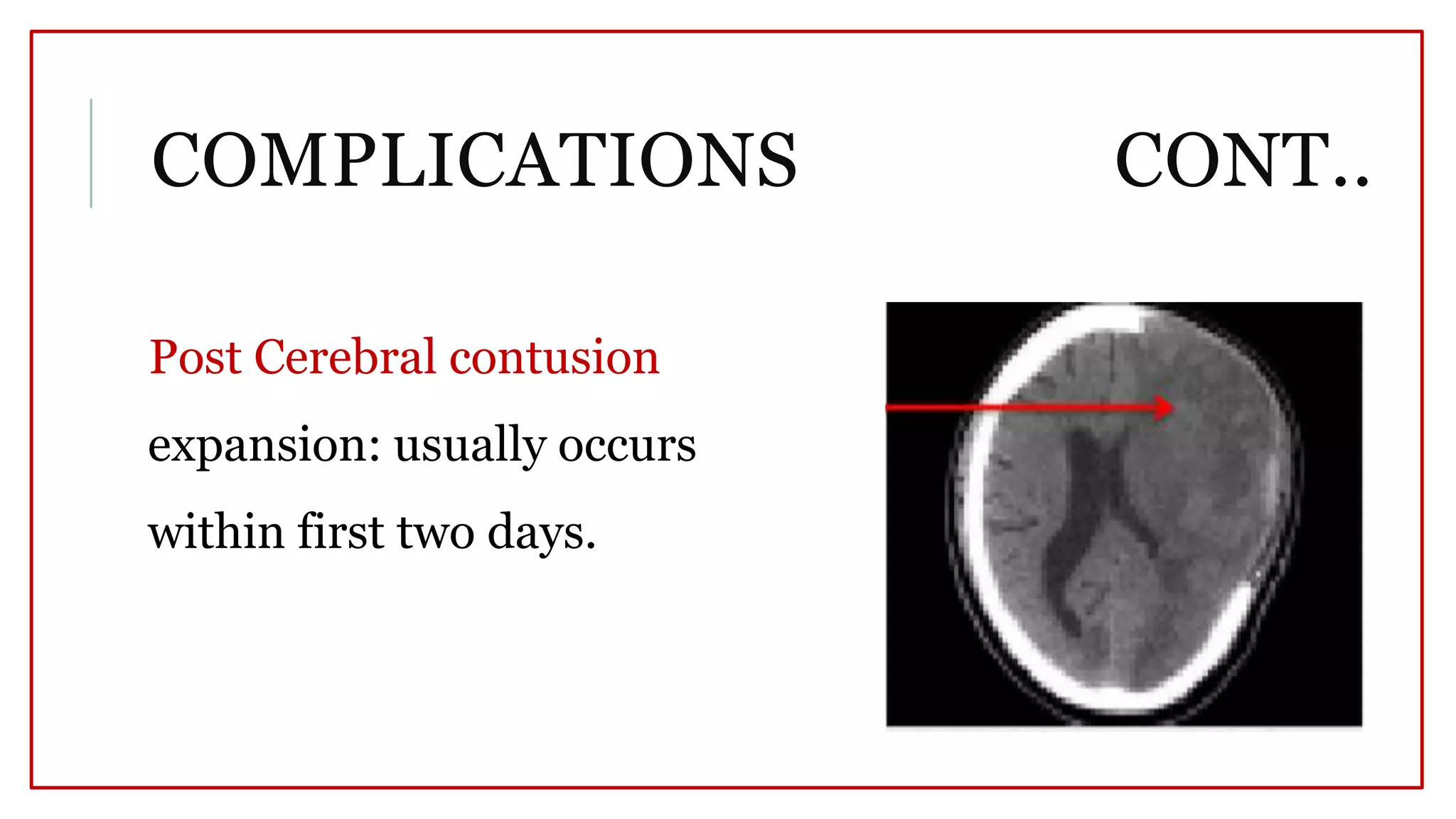 Decompressive craniectomy | PPTX