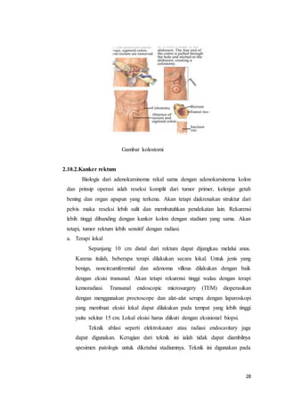 28 
Gambar kolostomi 
2.10.2.Kanker rektum 
Biologis dari adenokarsinoma rekal sama dengan adenokarsinoma kolon 
dan prinsip operasi ialah reseksi komplit dari tumor primer, kelenjar getah 
bening dan organ apapun yang terkena. Akan tetapi diakrenakan struktur dari 
pelvis maka reseksi lebih sulit dan membutuhkan pendekatan lain. Rekurensi 
lebih tinggi dibanding dengan kanker kolon dengan stadium yang sama. Akan 
tetapi, tumor rektum lebih sensitif dengan radiasi. 
a. Terapi lokal 
Sepanjang 10 cm distal dari rektum dapat dijangkau melalui anus. 
Karena itulah, beberapa terapi dilakukan secara lokal. Untuk jenis yang 
benign, noncircumferential dan adenoma villous dilakukan dengan baik 
dengan eksisi transanal. Akan tetapi rekurensi tinggi walau dengan terapi 
kemoradiasi. Transanal endoscopic microsurgery (TEM) dioperasikan 
dengan menggunakan proctoscope dan alat-alat serupa dengan laparoskopi 
yang membuat eksisi lokal dapat dilakukan pada tempat yang lebih tinggi 
yaitu sekitar 15 cm. Lokal eksisi harus diikuti dengan eksisional biopsi. 
Teknik ablasi seperti elektrokauter atau radiasi endocavitary juga 
dapat digunakan. Kerugian dari teknik ini ialah tidak dapat diambilnya 
spesimen patologis untuk diketahui stadiumnya. Teknik ini digunakan pada 
 