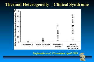 Thermal Heterogeneity – Clinical SyndromeThermal Heterogeneity – Clinical Syndrome
Stefanadis et al, Circulation April 1999
 