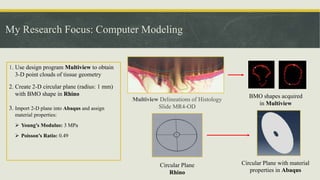 My Research Focus: Computer Modeling
1. Use design program Multiview to obtain
3-D point clouds of tissue geometry
2. Create 2-D circular plane (radius: 1 mm)
with BMO shape in Rhino
3. Import 2-D plane into Abaqus and assign
material properties:
 Young’s Modulus: 3 MPa
 Poisson’s Ratio: 0.49
Multiview Delineations of Histology
Slide MR4-OD
BMO shapes acquired
in Multiview
Circular Plane
Rhino
Circular Plane with material
properties in Abaqus
 