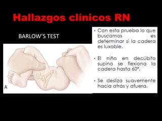 BARLOW’S TEST
Hallazgos clínicos RN
 
