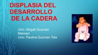DISPLASIA DEL
DESARROLLO
DE LA CADERA
Univ. Abigail Guzman
Mamani
Univ. Paulina Guzman Tola
 