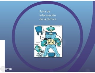 cirugia laparascopica