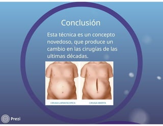 cirugia laparascopica