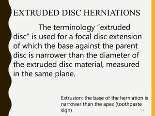Degenerative disc disease (DDD) | PPTX