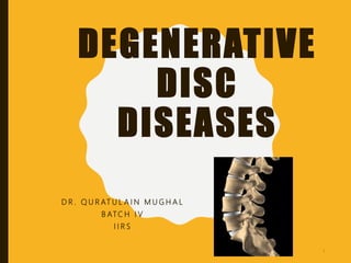 DEGENERATIVE
DISC
DISEASES
D R . Q U R AT U L A I N M U G H A L
B ATC H I V
I I R S
1
 