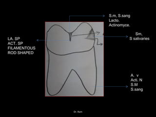 S.m, S.sang
Lacto.
Actinomyce.
Sm,
S salivaries
A. v
Acti. N
S.M
S.sang
LA. SP
ACT. SP
FILAMENTOUS
ROD SHAPED
Dr. Ram
 