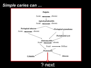 Simple caries can …
? nextDr. Ram
 