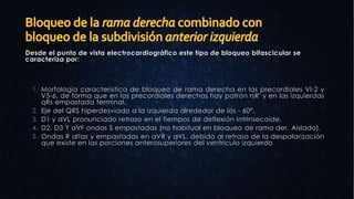 Desde el punto de vista electrocardiográfico este tipo de bloqueo bifascicular se
caracteriza por:
1. Morfología característica de bloqueo de rama derecha en las precordiales VI-2 y
V5-6, de forma que en las precordiales derechas hay patrón rsR' y en las izquierdas
qRs empastada terminal.
2. Eje del QRS hiperdesviado a la izquierda alrededor de los - 60°.
3. D1 y aVL pronunciado retraso en el tiempos de deflexión intrinsecoide.
4. D2, D3 Y aVF ondas S empastadas (no habitual en bloqueo de rama der. Aislado).
5. Ondas R altas y empastadas en aVR y aVL, debido al retraso de la despolarización
que existe en las porciones anterosuperiores del ventrículo izquierdo
 