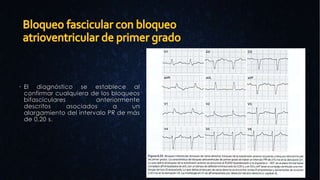  El diagnóstico se establece al
confirmar cualquiera de los bloqueos
bifasciculares anteriormente
descritos asociados a un
alargamiento del intervalo PR de más
de 0,20 s.
 