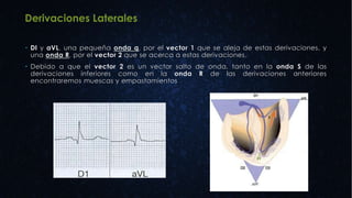  DI y aVL, una pequeña onda q, por el vector 1 que se aleja de estas derivaciones, y
una onda R, por el vector 2 que se acerca a estas derivaciones.
 Debido a que el vector 2 es un vector salto de onda, tanto en la onda S de las
derivaciones inferiores como en la onda R de las derivaciones anteriores
encontraremos muescas y empastamientos
 