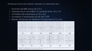  El bloqueo fascicular anterior izquierdo se caracteriza por:
1. Duración del QRS menor de 0,12 s.
2. Hiperdesviación del ÁQRS a la izquierda entre -45 y -75°.
3. Complejos qR empastados en DI y aVL.
4. Complejos rS empastados en D2, D3 Y aVF.
5. Retraso del tiempo de deflexión intrinsecoide en DI y aVL.
 
