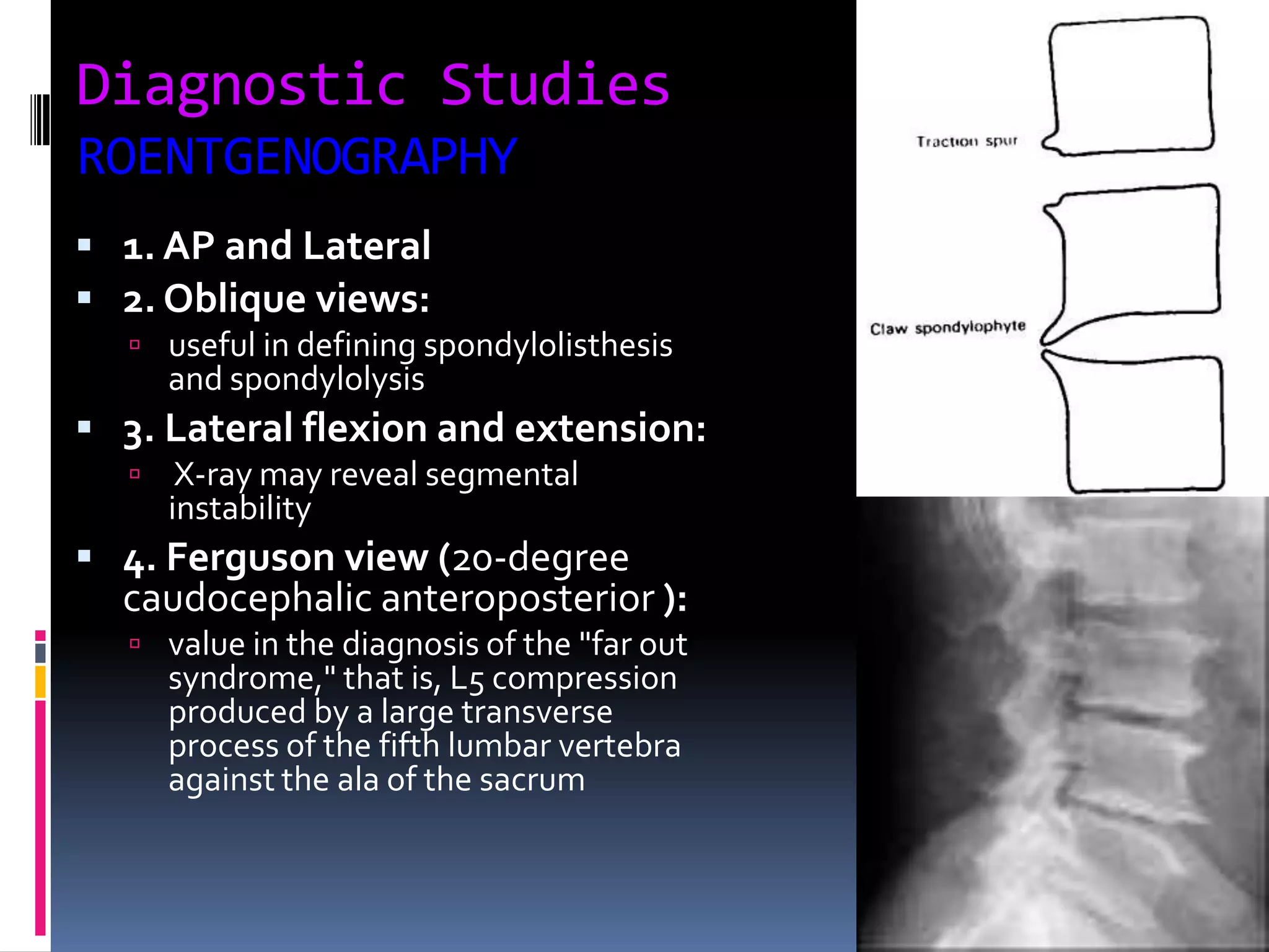 Diagnostic Studies
ROENTGENOGRAPHY
 1. AP and Lateral
 2. Oblique views:
 useful in defining spondylolisthesis

and spondylolysis

 3. Lateral flexion and extension:


X-ray may reveal segmental
instability

 4. Ferguson view (20-degree

caudocephalic anteroposterior ):
 value in the diagnosis of the "far out

syndrome," that is, L5 compression
produced by a large transverse
process of the fifth lumbar vertebra
against the ala of the sacrum

 