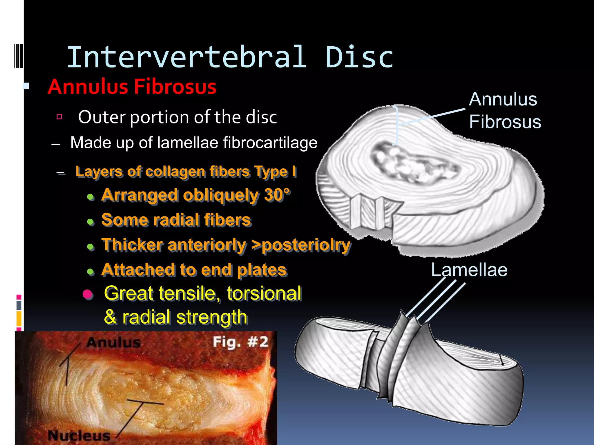 Intervertebral Disc

 Annulus Fibrosus

 Outer portion of the disc

Annulus
Fibrosus

– Made up of lamellae fibrocartilage
– Layers of collagen fibers Type I







Arranged obliquely 30°
Some radial fibers
Thicker anteriorly >posteriolry
Attached to end plates

Great tensile, torsional
& radial strength

Lamellae

 