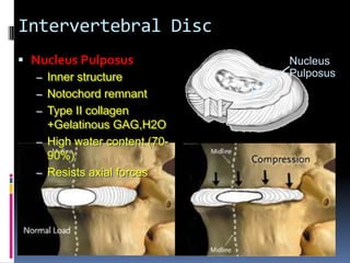 Intervertebral Disc
 Nucleus Pulposus
– Inner structure
– Notochord remnant

– Type II collagen

+Gelatinous GAG,H2O
– High water content (7090%)
– Resists axial forces

Nucleus
Pulposus

 