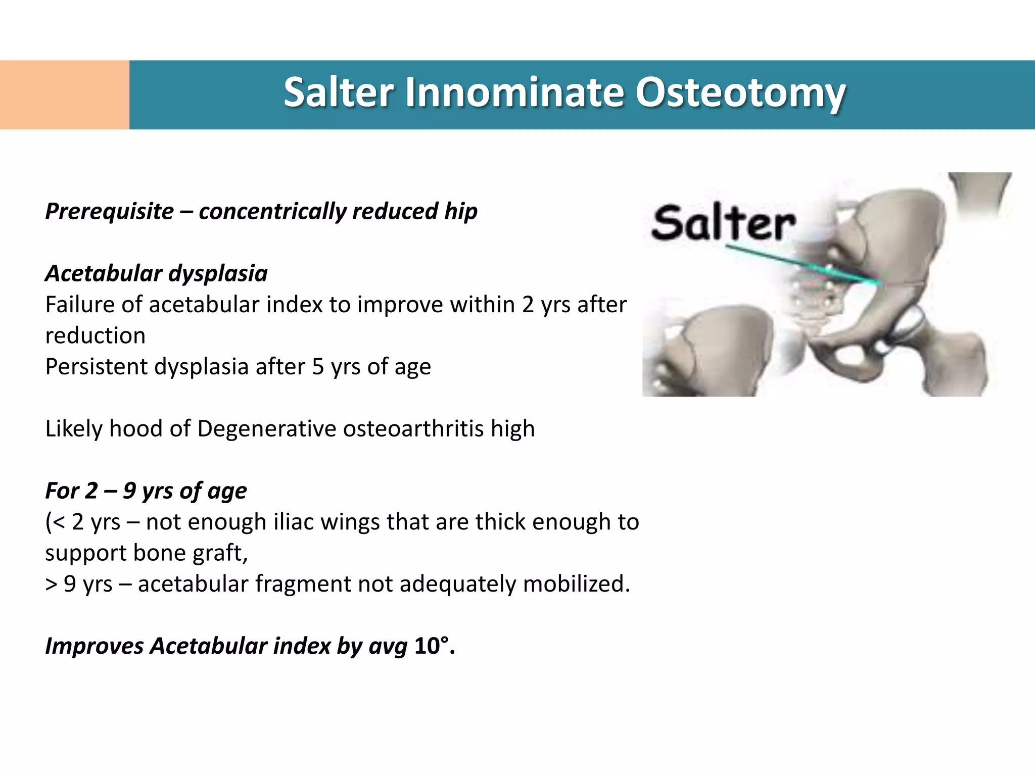 Salter Innominate Osteotomy

Prerequisite – concentrically reduced hip

Acetabular dysplasia
Failure of acetabular index to improve within 2 yrs after
reduction
Persistent dysplasia after 5 yrs of age

Likely hood of Degenerative osteoarthritis high

For 2 – 9 yrs of age
(< 2 yrs – not enough iliac wings that are thick enough to
support bone graft,
> 9 yrs – acetabular fragment not adequately mobilized.

Improves Acetabular index by avg 10°.
 