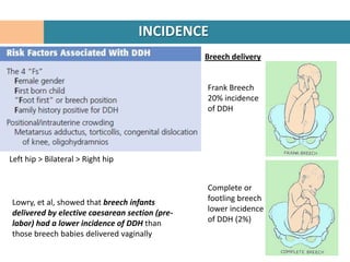 INCIDENCE
                                                Breech delivery


                                                Frank Breech
                                                20% incidence
                                                of DDH




Left hip > Bilateral > Right hip


                                                Complete or
Lowry, et al, showed that breech infants        footling breech
delivered by elective caesarean section (pre-   lower incidence
labor) had a lower incidence of DDH than        of DDH (2%)
those breech babies delivered vaginally
 