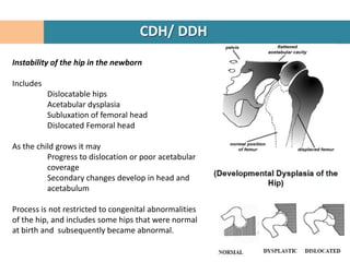 CDH/ DDH
Instability of the hip in the newborn

Includes
           Dislocatable hips
           Acetabular dysplasia
           Subluxation of femoral head
           Dislocated Femoral head

As the child grows it may
          Progress to dislocation or poor acetabular
          coverage
          Secondary changes develop in head and
          acetabulum

Process is not restricted to congenital abnormalities
of the hip, and includes some hips that were normal
at birth and subsequently became abnormal.
 