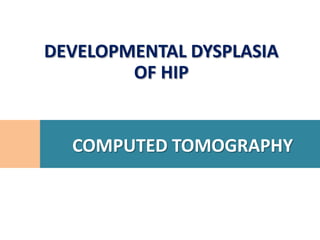 DEVELOPMENTAL DYSPLASIA
        OF HIP


  COMPUTED TOMOGRAPHY
 