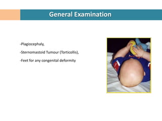General Examination


-Plagiocephaly,

-Sternomastoid Tumour (Torticollis),

-Feet for any congenital deformity
 