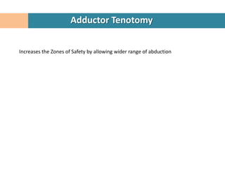 Adductor Tenotomy


Increases the Zones of Safety by allowing wider range of abduction
 