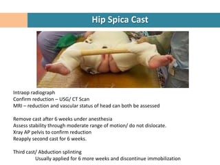 Hip Spica Cast




Intraop radiograph
Confirm reduction – USG/ CT Scan
MRI – reduction and vascular status of head can both be assessed

Remove cast after 6 weeks under anesthesia
Assess stability through moderate range of motion/ do not dislocate.
Xray AP pelvis to confirm reduction
Reapply second cast for 6 weeks.

Third cast/ Abduction splinting
          Usually applied for 6 more weeks and discontinue immobilization
 