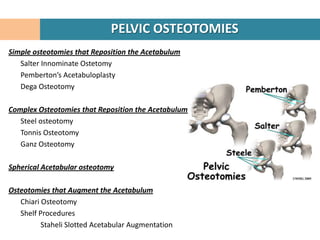 PELVIC OSTEOTOMIES
Simple osteotomies that Reposition the Acetabulum
   Salter Innominate Ostetomy
   Pemberton’s Acetabuloplasty
   Dega Osteotomy

Complex Osteotomies that Reposition the Acetabulum
   Steel osteotomy
   Tonnis Osteotomy
   Ganz Osteotomy

Spherical Acetabular osteotomy

Osteotomies that Augment the Acetabulum
   Chiari Osteotomy
   Shelf Procedures
          Staheli Slotted Acetabular Augmentation
 